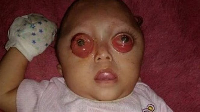 Mari sedekah Untuk Adnan