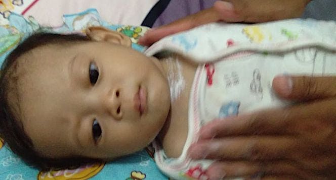 Jantung Bocor Sebesar 6mm, Bantu Fatih Sembuh