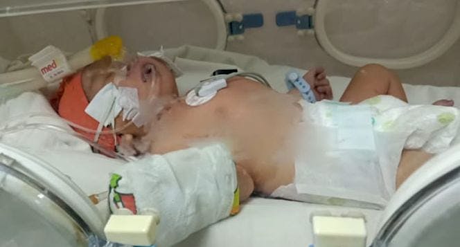 Bantu Bayi Raffa melawan infeksi paru paru