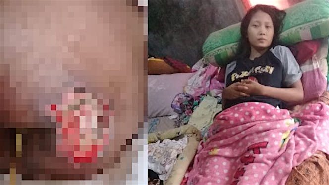 Bantu Devi sembuh pasca melahirkan