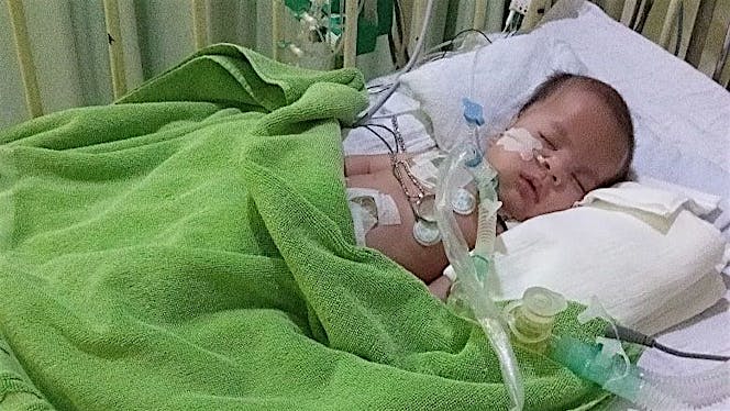 Bantu Tiara Melawan Pendarahan Otak Bawaan Lahir
