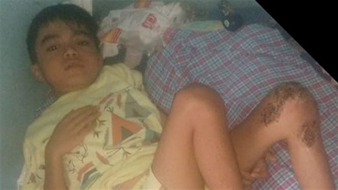 Hosea ingin bisa sembuh dan bisa sekolah lagi