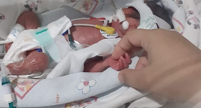 Bantu Adik Aiden Berjuang Hidup di NICU