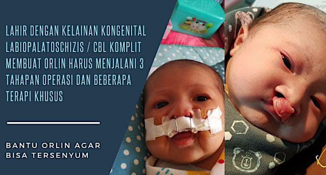 Bantu Orlin untuk tersenyum