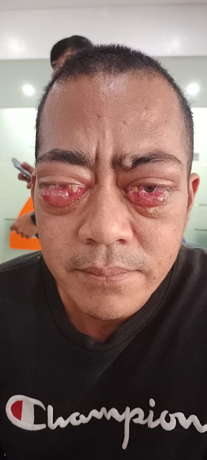 191e8646-a515-11f0-a752-1abb16330913_E2FA5CB4C1DAE45B.jpg?auto=compress,format&cs=tinysrgb&fm=pjpg