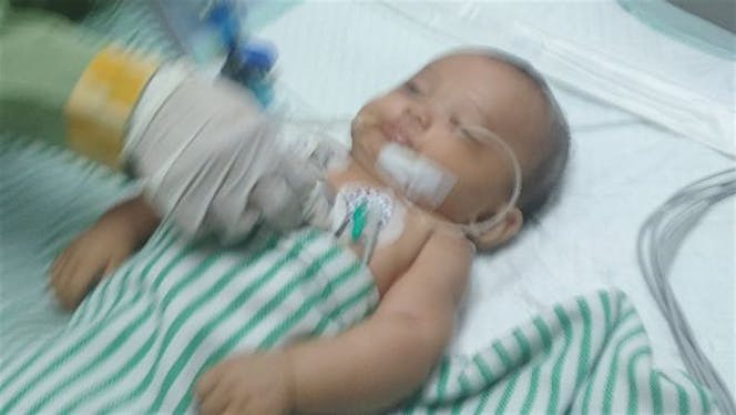 Bantu Jibril sembuh dari retak kepalanya