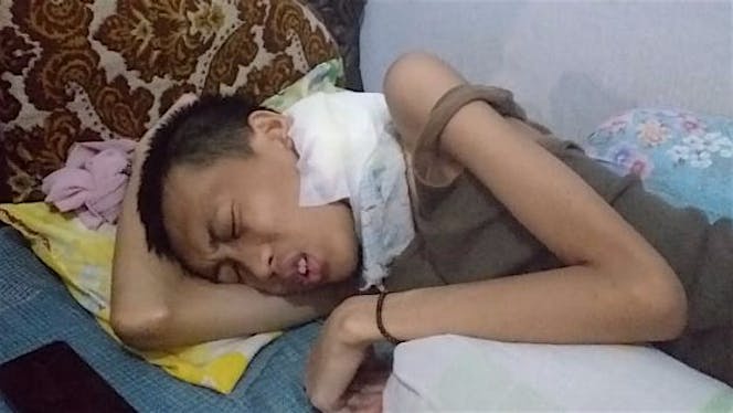 Bantu Feby Melawan Kanker Nasofaring