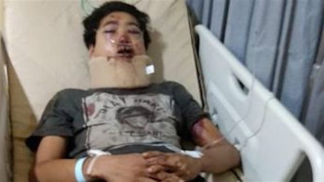 Bantu Raihan pulih dari Kecelakaan