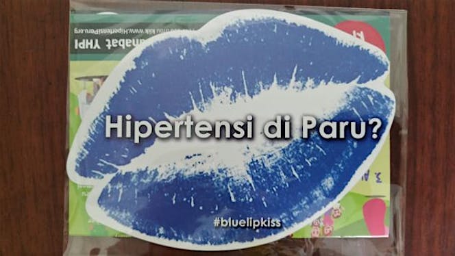 Jangkau 25.000 Pasien Hipertensi Paru di Indonesia