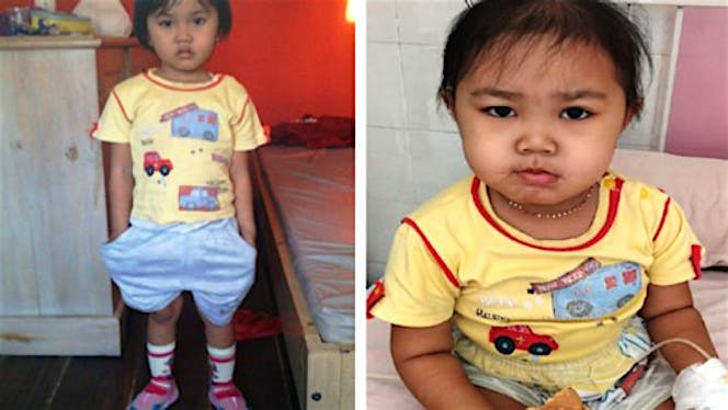 Bantu Eliza Safiya Melawan Kanker Darah