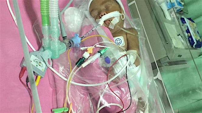 Bantu Keevara Bertahan Hidup di NICU