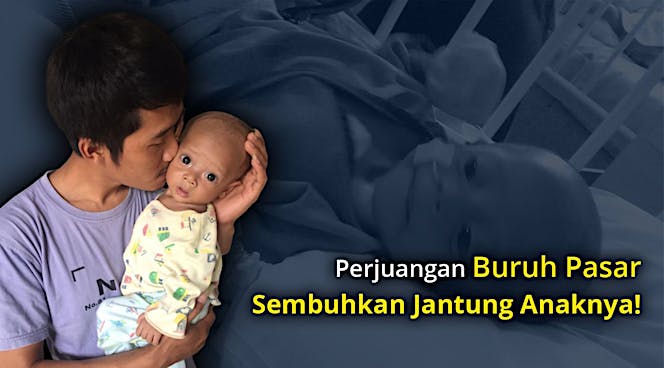 Bantu Anak Buruh Operasi Tutup Lubang Jantung