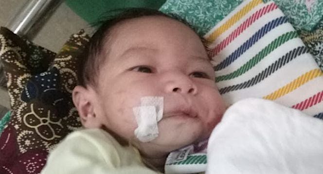 Bantu anak Abimanyu melawan megacolon