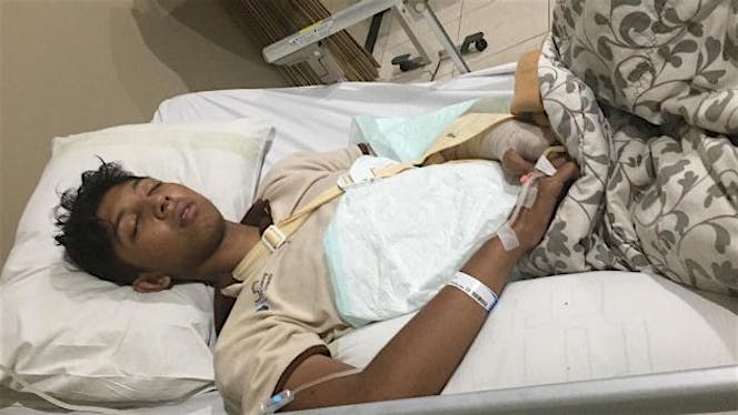 Bantu Budi untuk operasi patah tulang tangan