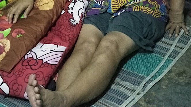 Bantu transport Bu Sugihartini untuk Kanker