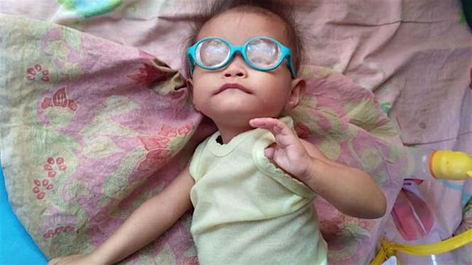 Bantu Adik Norra Untuk Sembuh Dari Komplikasi