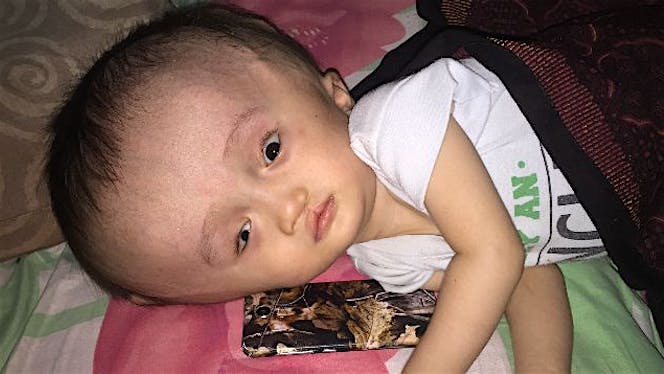 Semoga cepet sembuh