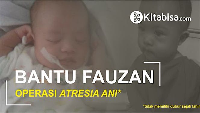 Bantu Fauzan Operasi Atresia Ani