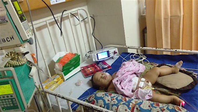 BANTU ALWI OPERASI PEMBUATAN ANUS