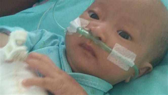 Bantu Anak Tukang Jahit Kalahkan 3 Penyakit Otak