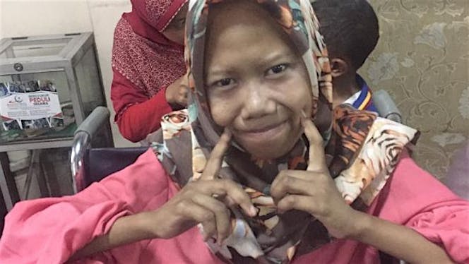 Bantu Alvianita melawan Lupus