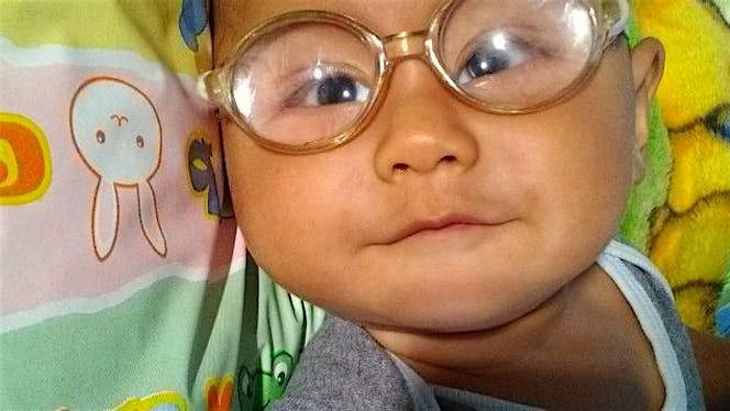 Bantu Uwais Pejuang Congenital Rubella Syndrome