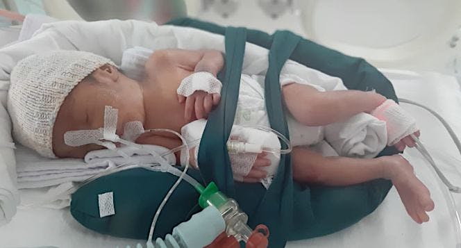 Bantu Kafka keluar dari NICU