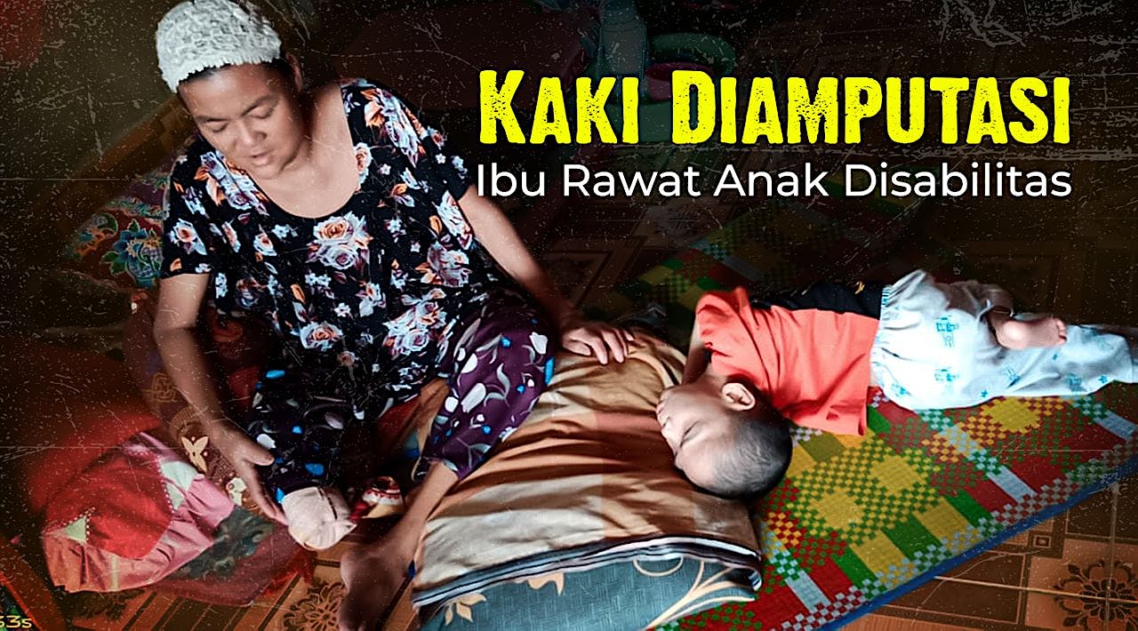 Kaki Diamputasi, Indaria Rawat Anak Disabilitasnya