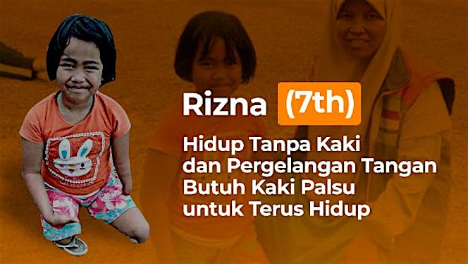 Kaki Palsu untuk Rizna & Warga Dhuafa