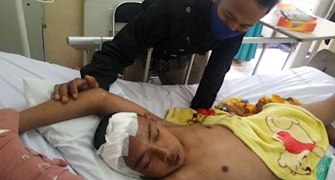 Bantu Anak Tukang Bangunan Operasi Pendarahan Otak