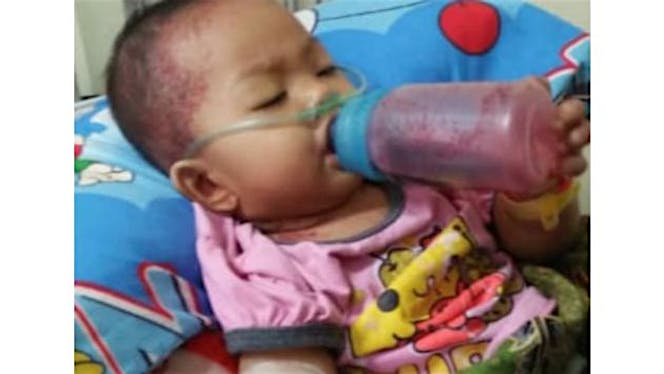 Bantu Ade kiya melawan leukemia