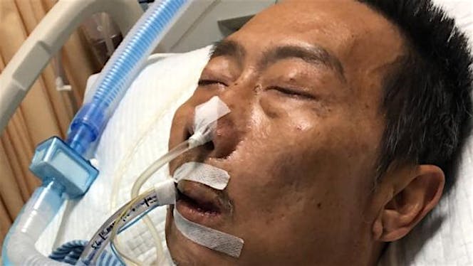 Bantu Om Herman melawan Sepsis