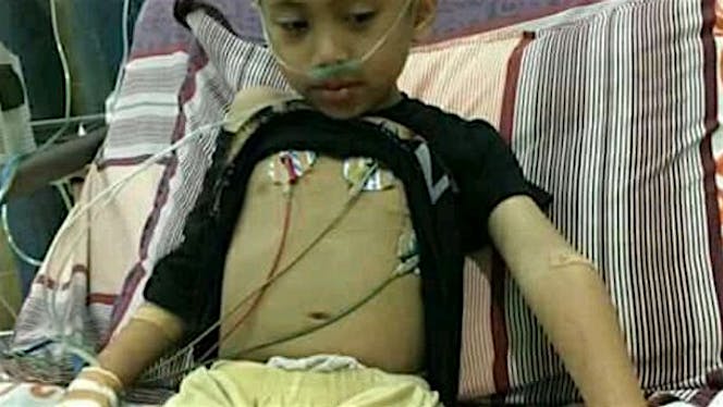 Bantu Ilham melawan bronkopnemonia