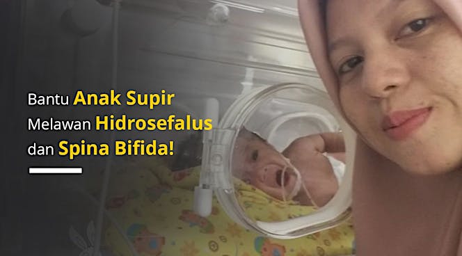 Bantu Shawqil, Lawan Hidrosefalus & Spina Bifida