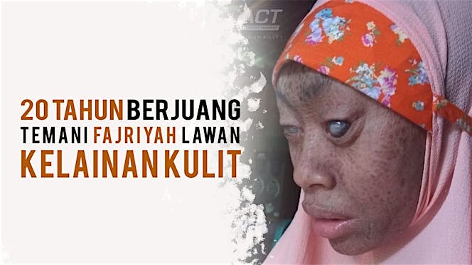 Dukung Fajriyah Lawan Iktiosis Lamelar