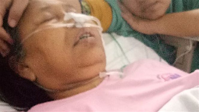 bantu ibu gagal ginjal dan komplikasi