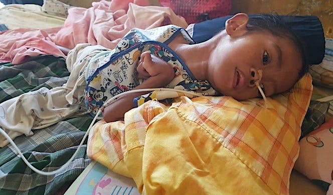 Bantu Anak Pengamen Jalanan Kalahkan Lumpuh Otak