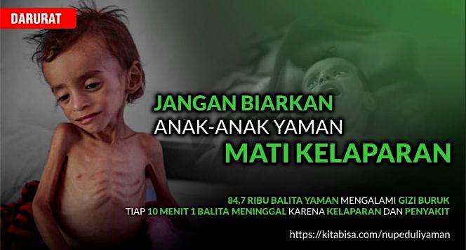 Selamatkan Anak-Anak Yaman dari Ancaman Kematian