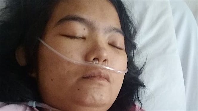 Bantu Reny melawan lupus