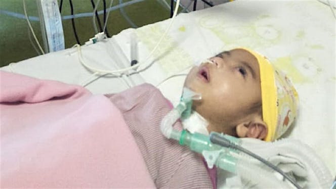 Aqil Lawan Kelainan Genetika dan Bronchopneumonia