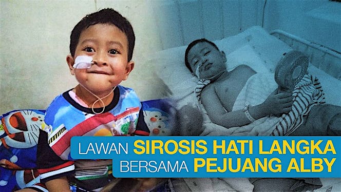 Bantu Alby Pejuang Sirosis Hati