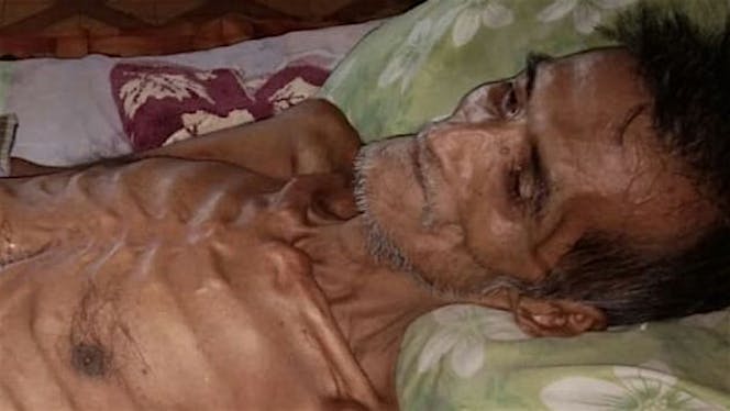Bantu Pak Herman menghadapi penyakitnya