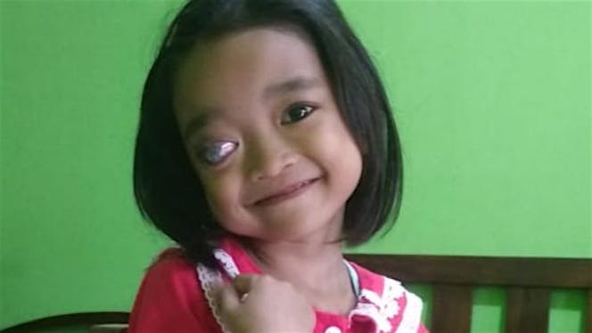 Bantu Rere Melawan Kanker Mata