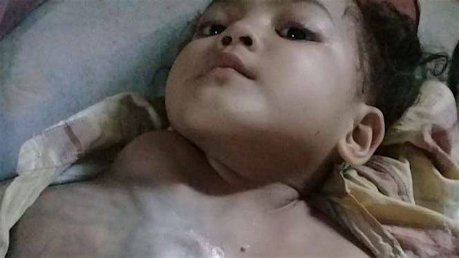 Bantu Siti Azizah melawan tumor ganas