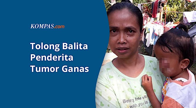 Balita 4 Tahun Menderita Tumor Ganas