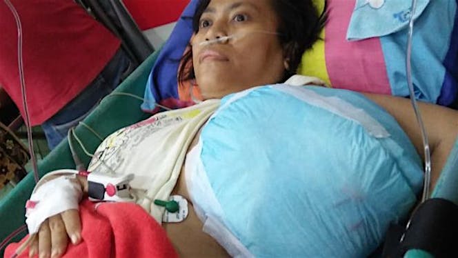 Bantu Bunda Ocha sembuh dr kanker Payudara st lnjt