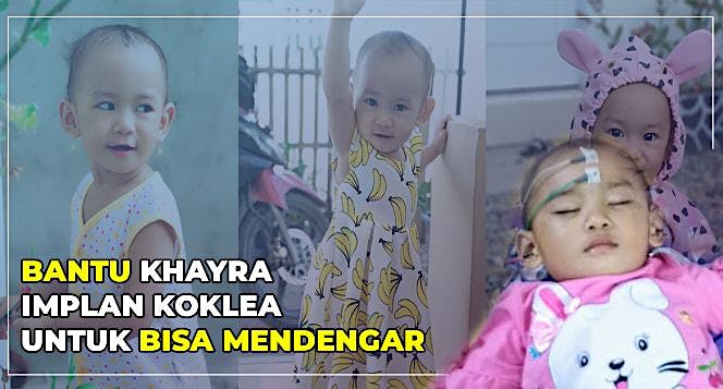 BANTU KHAYRA IMPLAN KOKLEA UNTUK BISA MENDENGAR