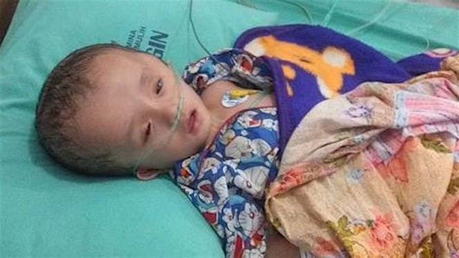 Bantu Wali (2 thn) Sembuh dari Hidrosefalus