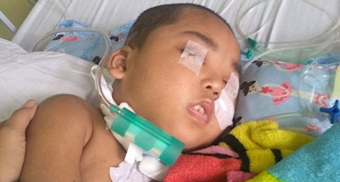 Bantu Reza Lawan Cerebral Palsy & Pendarahan Otak