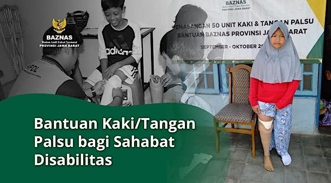 Bantuan Kaki/Tangan Palsu bagi Sahabat Disabilitas